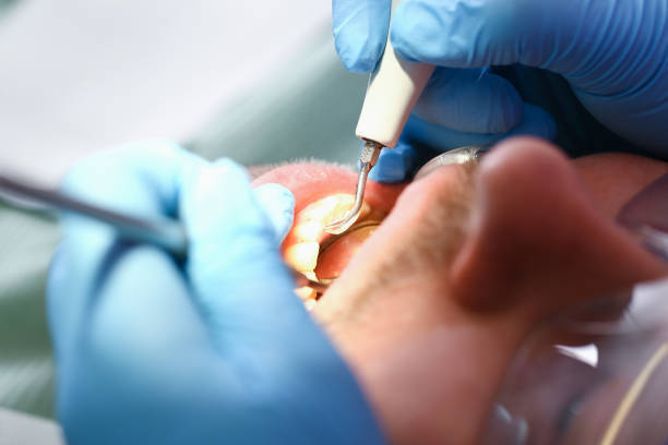 Best Weekend Emergency Dental Services in Desoto, TX