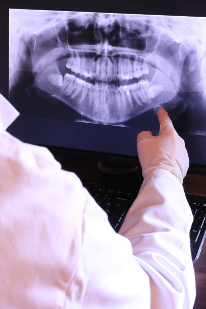 Best Broken or Chipped Tooth Repair in Desoto, TX