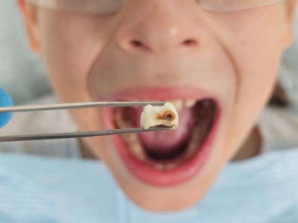 Best Emergency Pediatric Dental Care in Desoto, TX